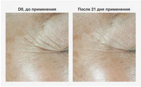 Пептилиум.JPG Пептилиум.JPG