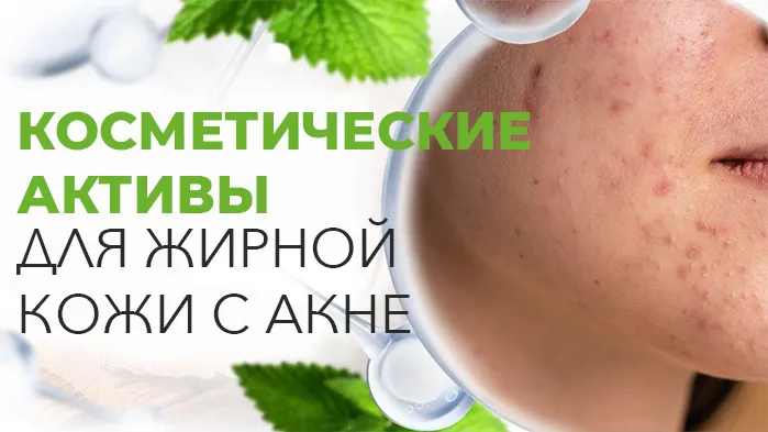 Косметические активы для жирной кожи с акне Косметические активы для жирной кожи с акне.jpg