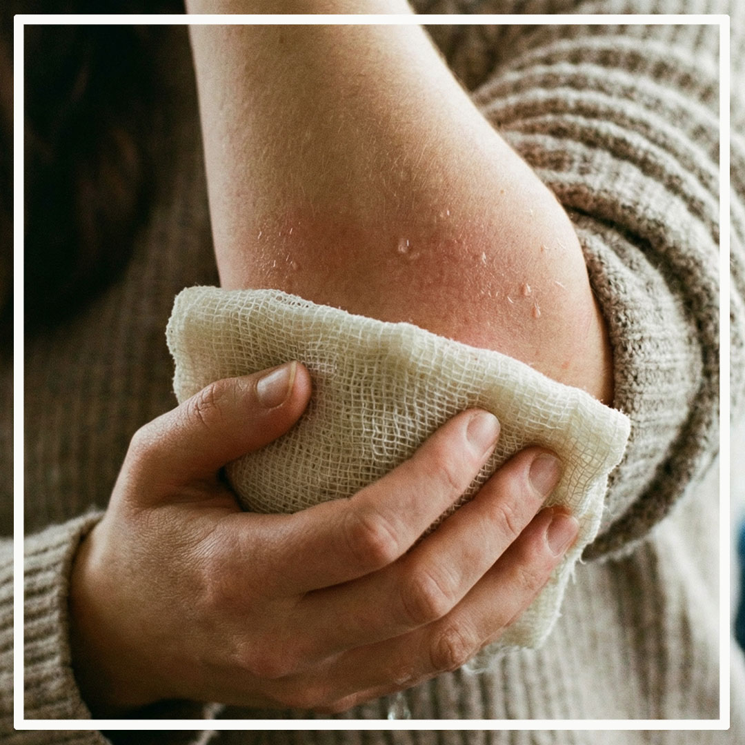 Компресс из касторового масла